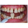 牙齿局部修复可信赖——找一流的牙齿局部修复就到魏家口腔